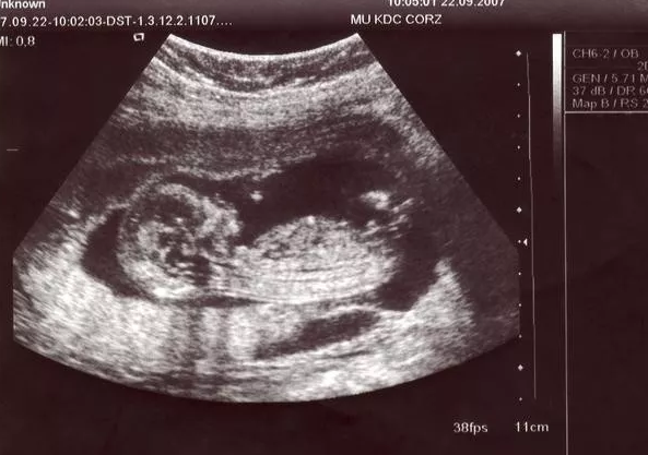 2019年1月12号行房受孕生男生女 农历腊月初六怀孕生男孩还是女孩