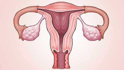 子宫内膜癌有哪些早期征兆 子宫内膜癌早期信号