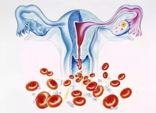 子宫内膜增厚怎么办 子宫内膜增厚可以治疗吗