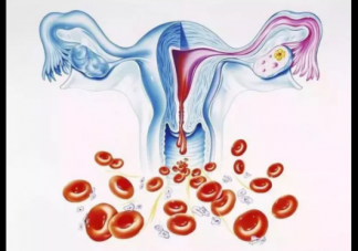 子宫内膜增厚怎么办 子宫内膜增厚可以治疗吗