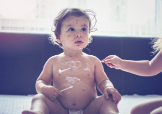 湿疹皮炎春季容易出的疹子家长如何做好预防 宝宝长了疹子该怎么护理