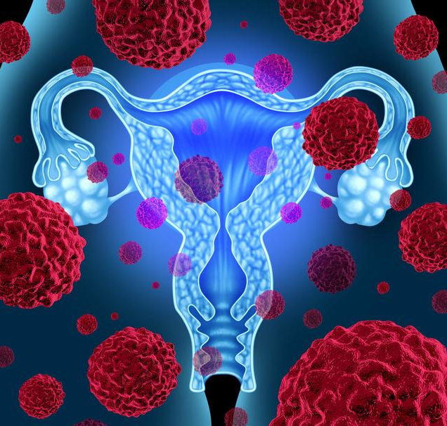 感染了HPV病毒多久会发展为宫颈癌 宫颈癌初期症状