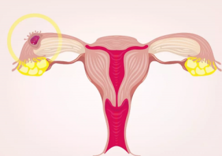 输卵管介入怎么做 输卵管介入后能怀孕吗