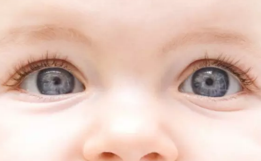 双眼皮父母会生出单眼皮孩子吗 单眼皮孩子概率大吗