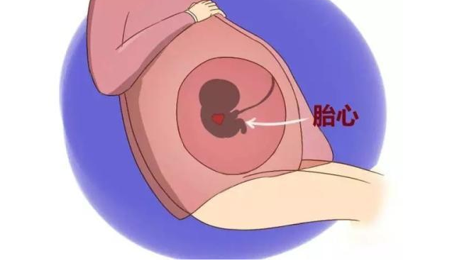 怎么判断胎停育了 怀孕查不到胎芽胎心是胎停育了吗