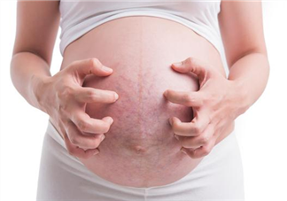 妊娠纹什么时候长 妊娠纹祛除小方法