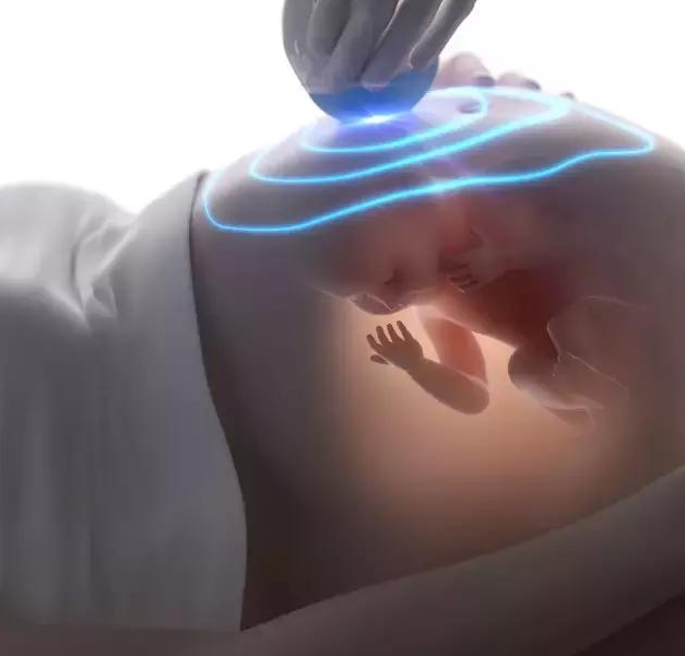 四维彩超胎儿总是趴着怎么回事 做四维彩超宝宝不配合怎么办