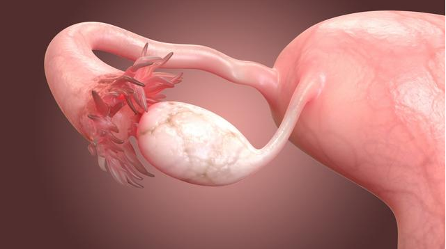 女性卵巢早衰有什么表现 卵巢早衰怎么治疗