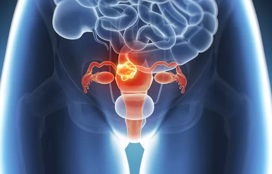 2019保护子宫和卵巢方法 怎么保护子宫和卵巢 